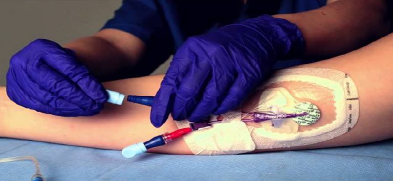 It contains medical-grade sponges saturated with 70% isopropyl alcohol to disinfect and protect IV connectors between uses.